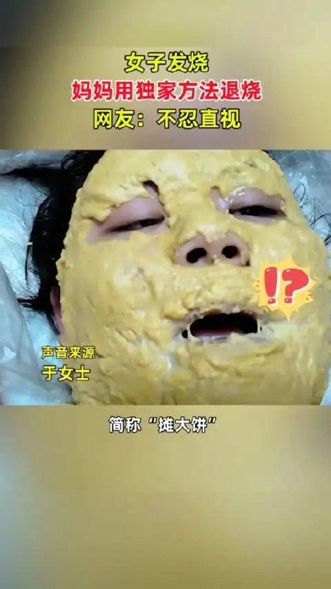 图片[1]-妈妈给女儿脸上“摊大饼”退烧：效果很意外-玩转网 | 902D.Com